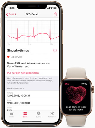 EKG-App von watchOS
